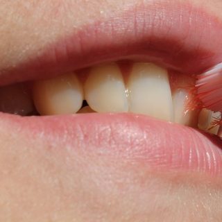 Mit diesen Hausmittel und Tipps Zahnfleischbeschwerden natürlich heilen
