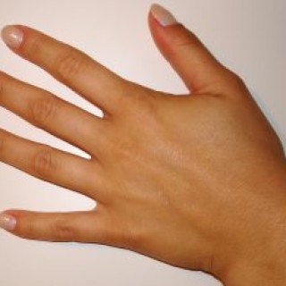 Hautpilz kann an Händen, im Gesicht, am Fuß und am ganzen Körper auftreten. Hausmittel bekämpfen ihn zuverlässig.